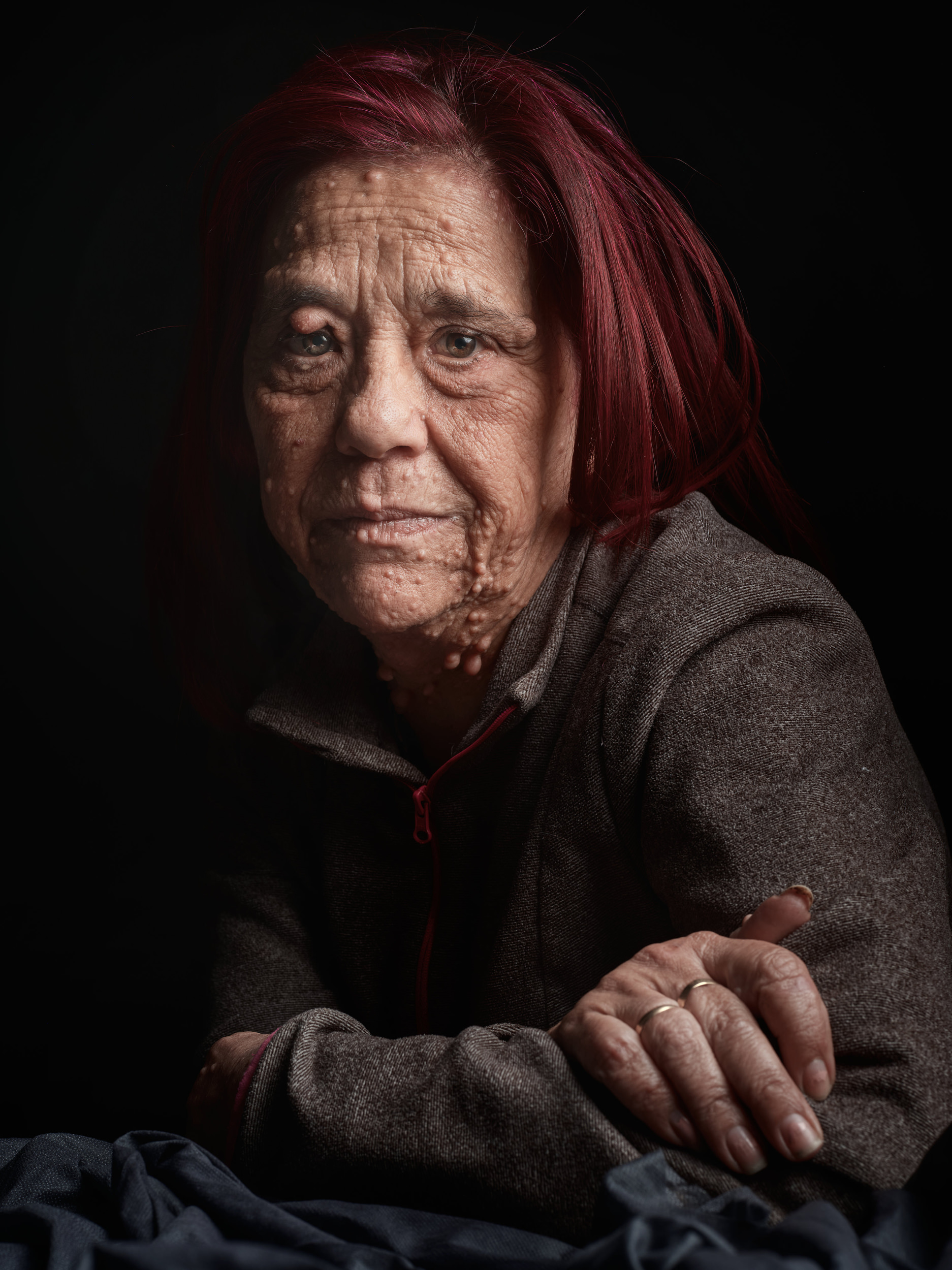 AMPARO